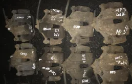 Суппорт передний правый для Kia Ceed 1 ED 2006-2009